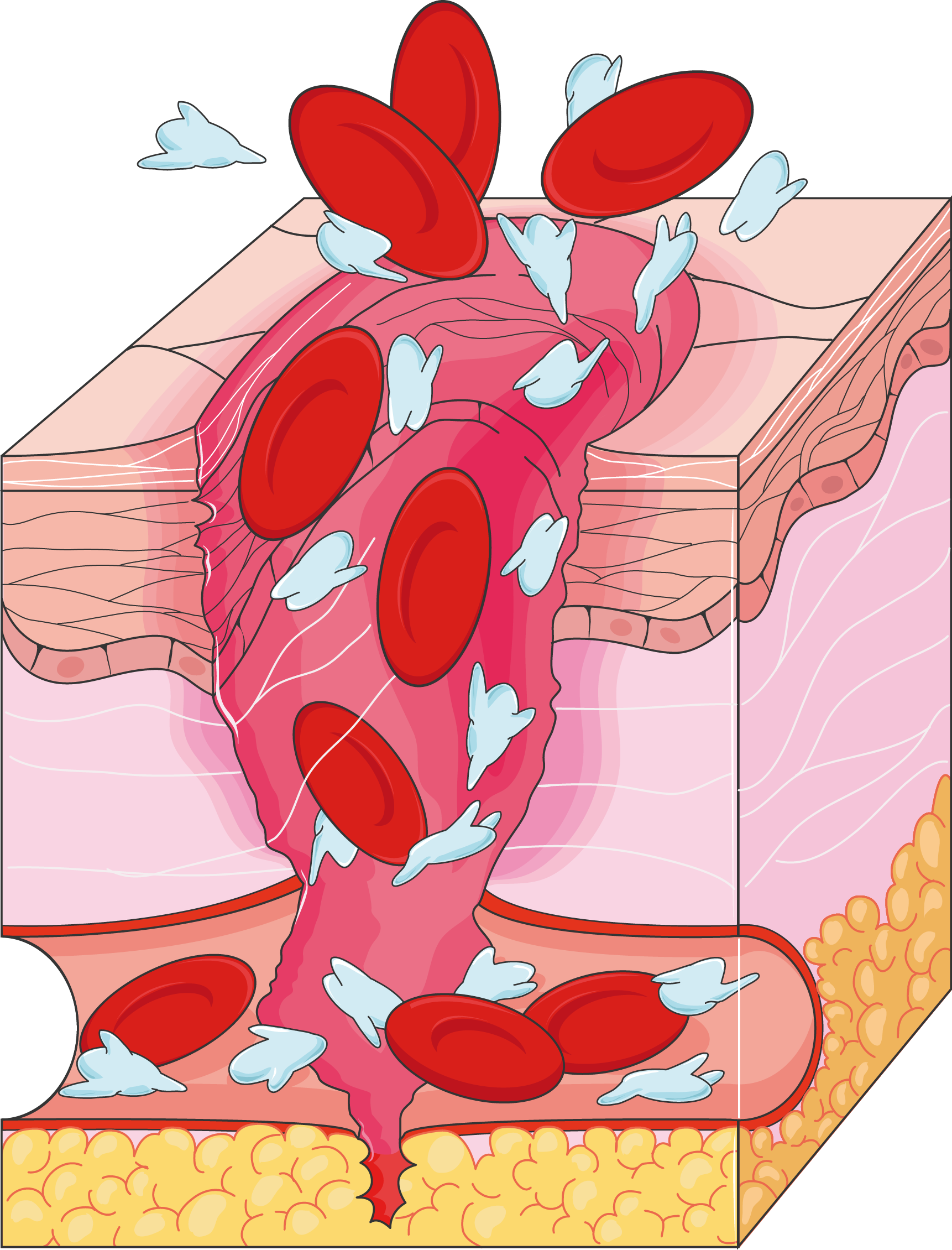 Blood - Coagulation (1722x2260), Png Download