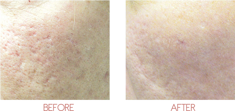 About - Scar (800x400), Png Download