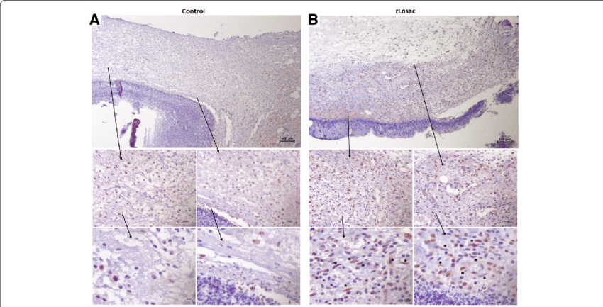 Assessment Of Scar Tissue By Pcna Immunohistochemistry - Common Fig (850x433), Png Download