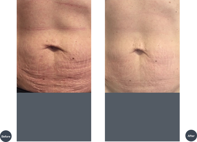 September - Wood (661x475), Png Download