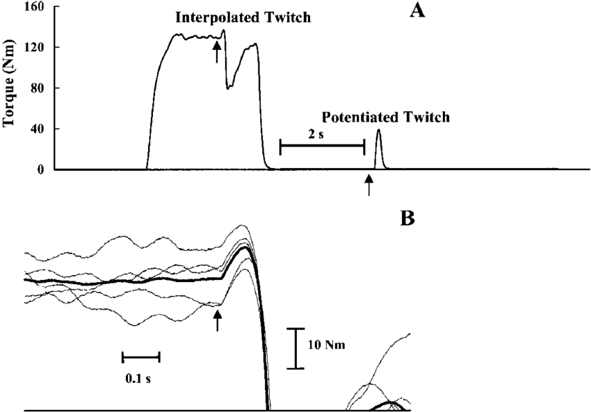 A Typical Example Of Measurement Using The Twitch Interpolation - Measurement (850x593), Png Download