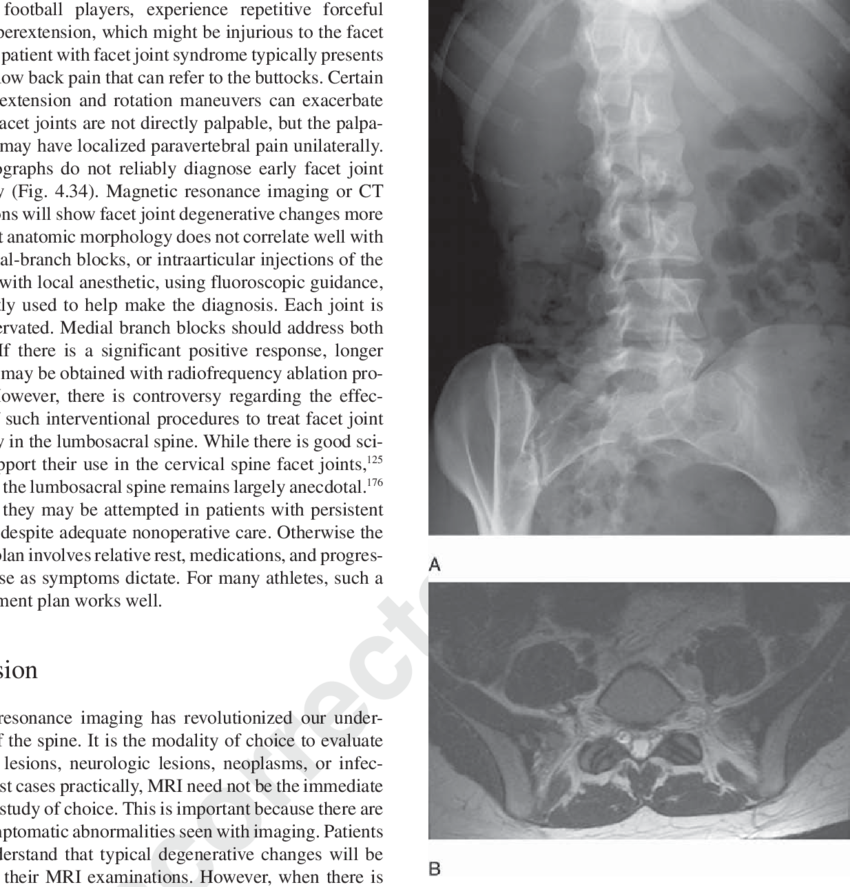 A 23 Year Old Woman With A 1 Year History Of Axial - Radiography (850x887), Png Download