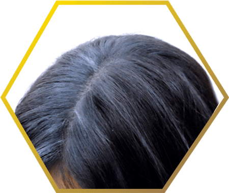 Premature Grey Hair - Premature Greying Of Hair (450x380), Png Download