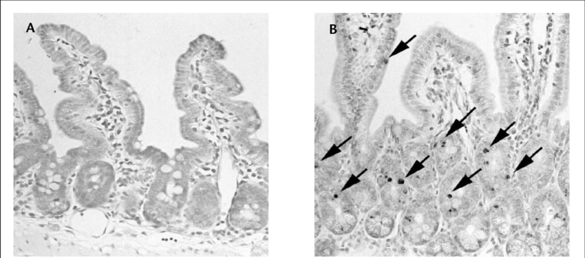 Apoptotic Changes In The Intestines Of Mice Induced - Photograph (850x376), Png Download