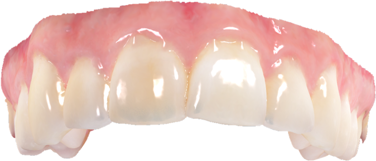Digitalization Technology - Dentures (800x361), Png Download
