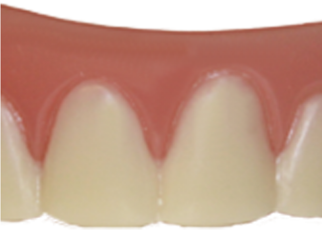 Teeth Png Transparent Images - Portable Network Graphics (640x480), Png Download