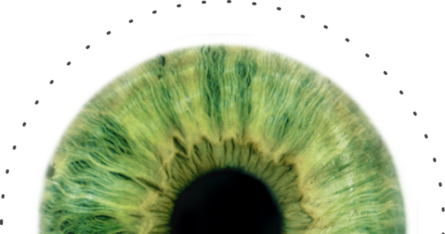 With Conventional Macular Laser - Close-up (500x263), Png Download