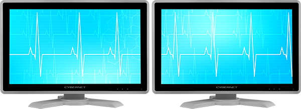 Dual Display - Medical Screen (600x219), Png Download