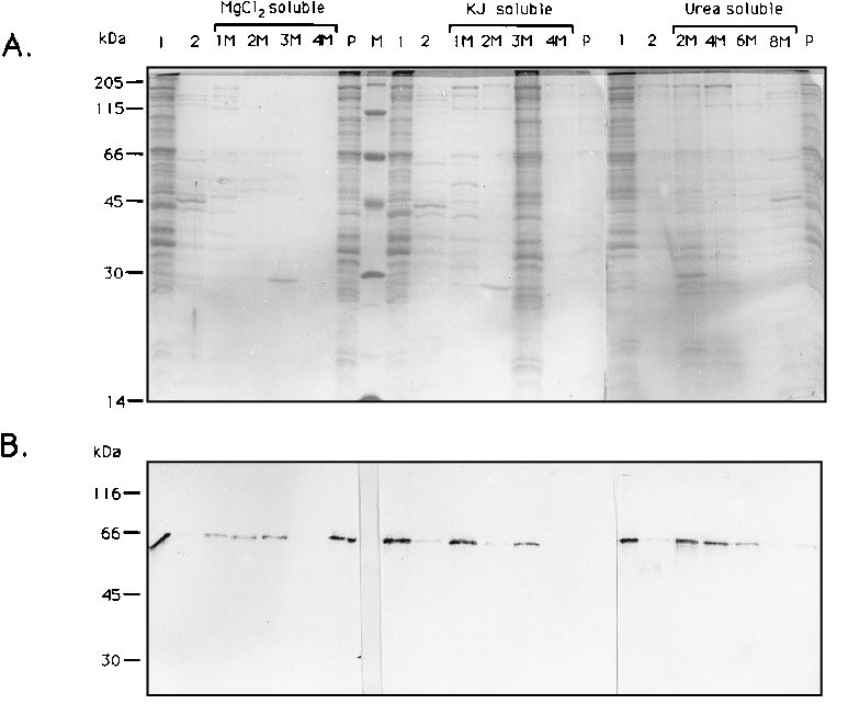 Silver-stained Sds 12% Polyacrylamide Gel Of Triton - Diagram (826x644), Png Download