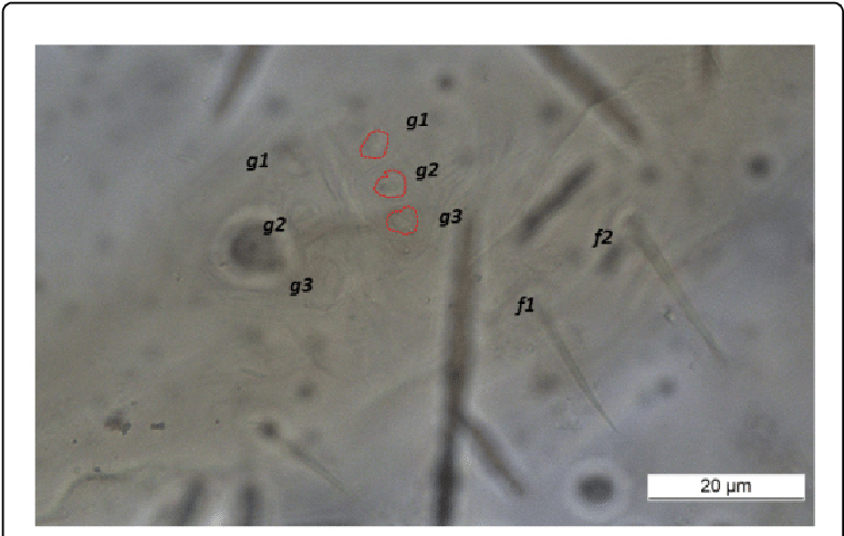 Ventral View Of Female Ophioptes Ekans N (769x488), Png Download
