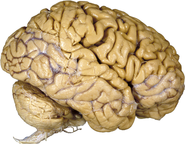Cerebro - Human Brain (631x488), Png Download