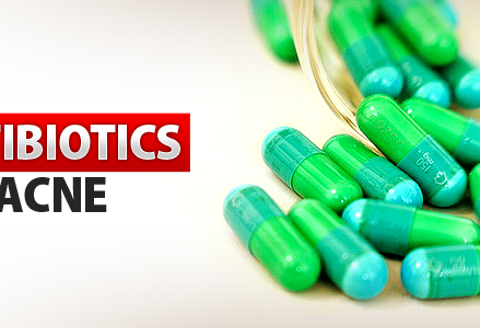 Banning Antibiotics For Acne - Acne Antibiotics (439x300), Png Download