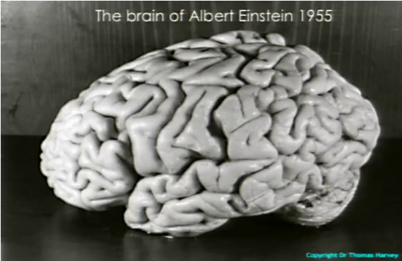 Throughout History, Body Parts Of Geniuses Shards Of - Albert Einstein Death Place (733x376), Png Download