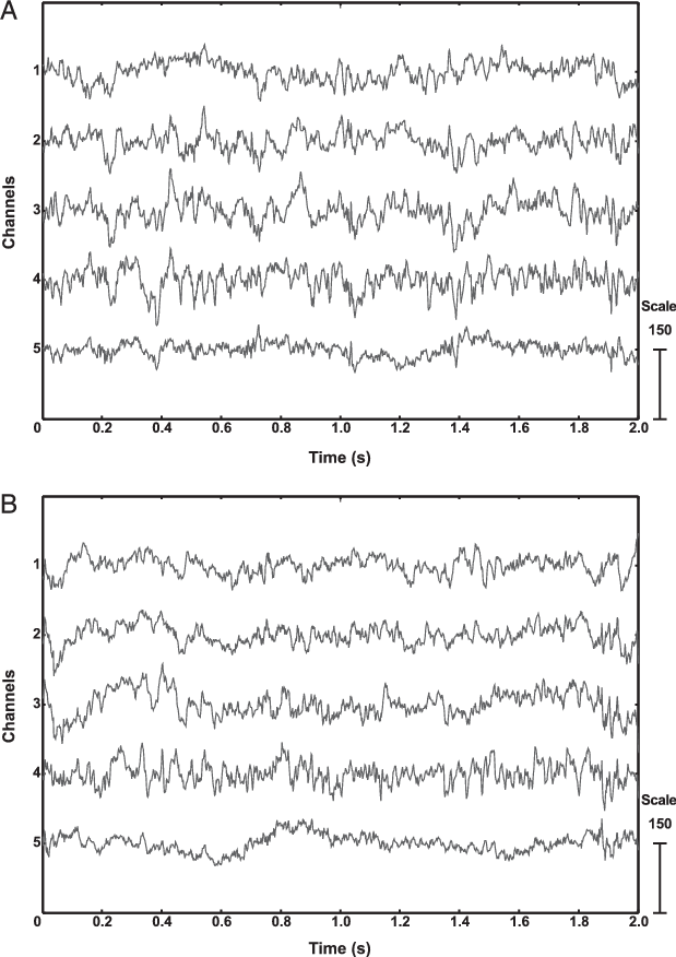 Eeg Record From The Flying And Resting Pigeon (b) That - Flight (619x876), Png Download