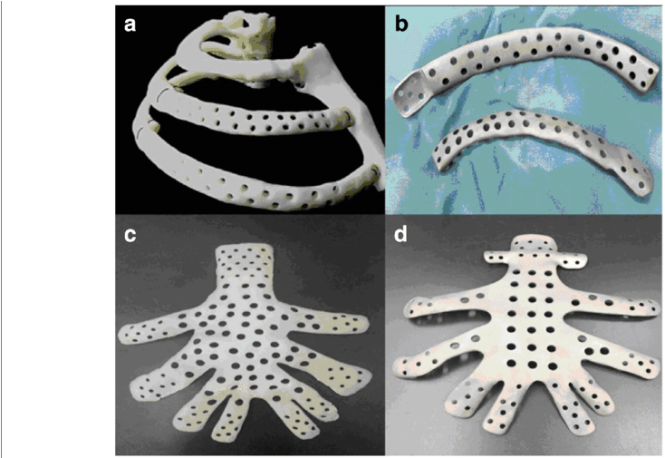 A, C Chest Reference Models For Cases 1 And 2, Respectively - 3d Printing (850x504), Png Download