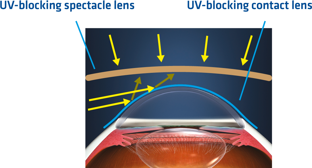 Sunglasses Plus Uv-blocking Contact Lenses - Uv Blocking Contact Lenses (1153x565), Png Download
