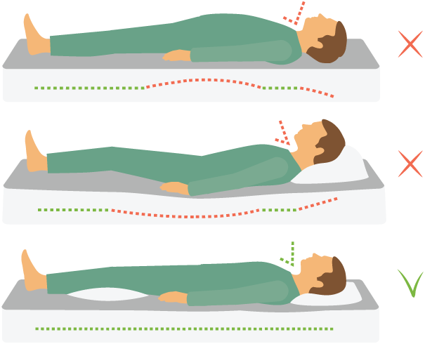 What To Look For In A Good Mattress For A Back Sleeper - Wirbelsäule Schlafen (605x490), Png Download