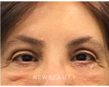 Dr Dav - Close-up (367x441), Png Download