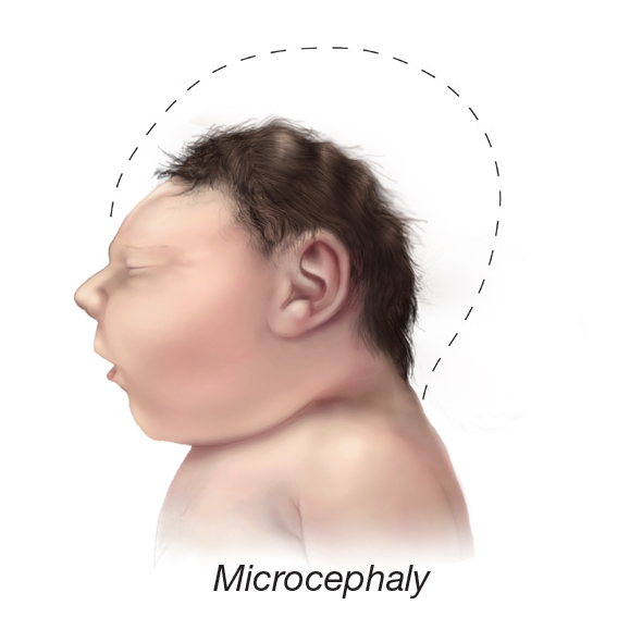 Baby Small Head - Pregnant Head (590x590), Png Download