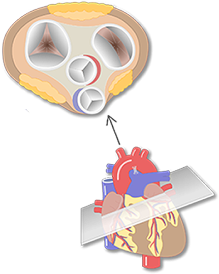 Anatomy And Function - Heart Valve (1200x630), Png Download