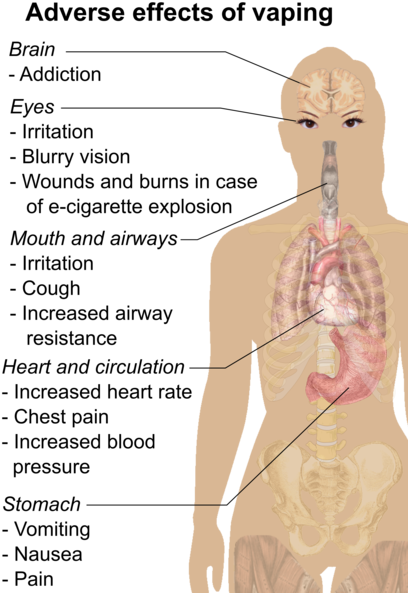 Possible Adverse Effects Of Vaping - Vaping Effects (440x596), Png Download