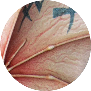 It's Worth Pointing Out That How I Use The Term Stippling - Maple Leaf (397x397), Png Download