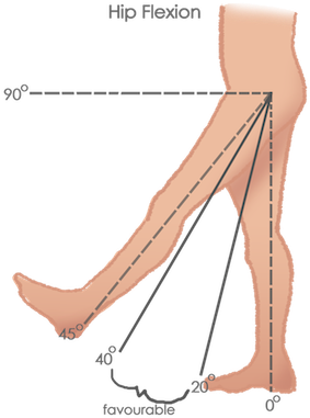 Hip Pic 1 - 45 Degree Hip Flexion (360x499), Png Download
