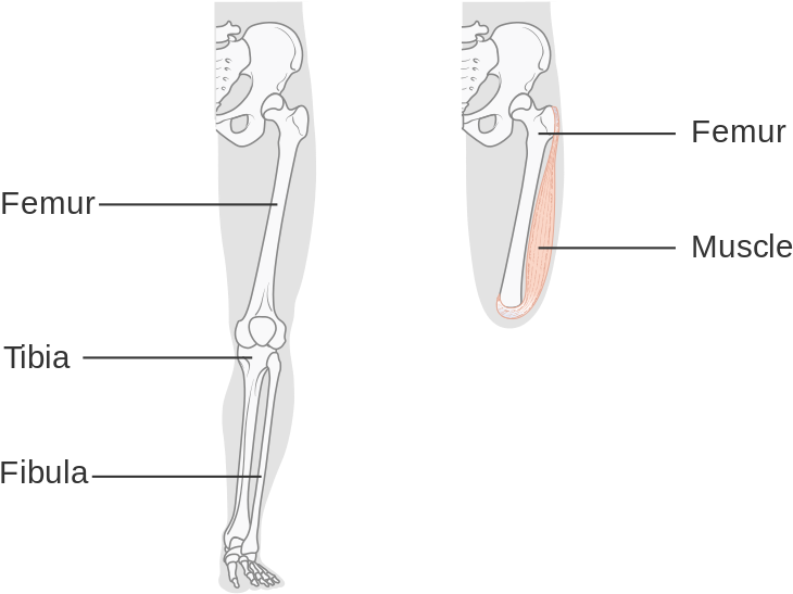 Fig 1 Above Knee Amputation - Above Knee Amputations Diagram (790x600), Png Download