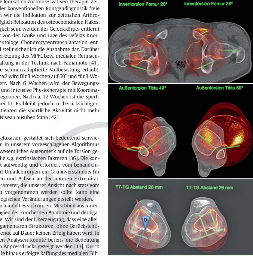 9 Zusammenhang Torsion Und Tt‑tg-abstand - Tt Tg Winkel (842x853), Png Download