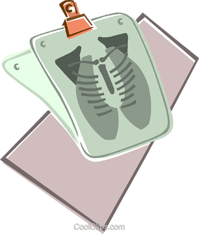 X-ray Of The Chest Royalty Free Vector Clip Art Illustration - Raio X Torax Png (408x480), Png Download