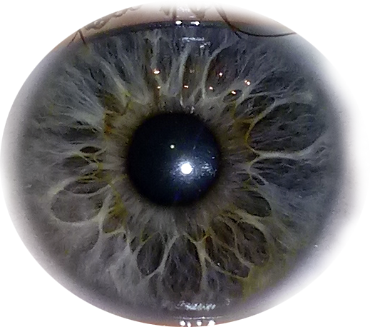 I Tried To Edit Out My Oily Eyelids And Eyelashes And - Circle (519x458), Png Download