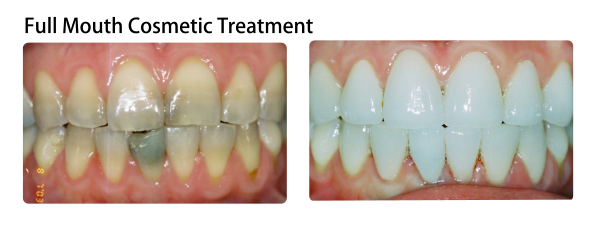 Mouth - Human Mouth (594x226), Png Download