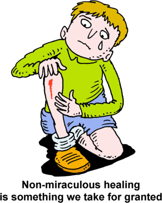 Skinned Knee - Cut On The Leg Clipart (319x400), Png Download