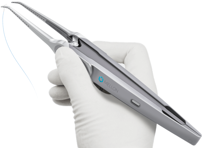 Suturing Is Performed With Great Efficiency, As The - Mellon Medical Switch (686x513), Png Download