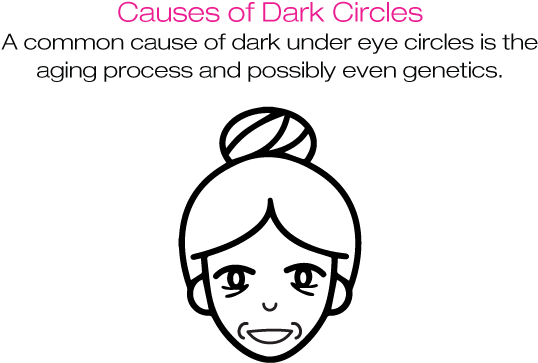 Here Are Some Of The Causes Of Dark Circles, As Well - Botulinum Toxin (800x400), Png Download