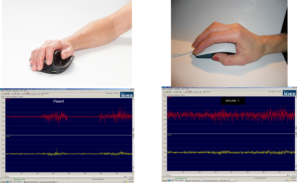 Emg Measurements - Emg In Ergonomics Mouse (1011x624), Png Download