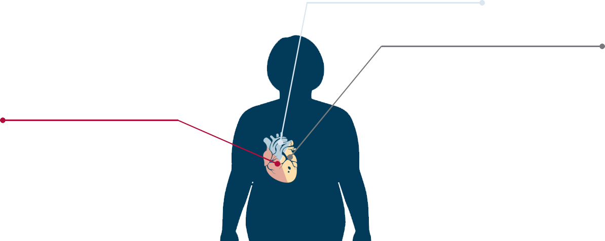 Types Of Obesity Related Heart Disease - Cast A Fishing Line (1194x476), Png Download