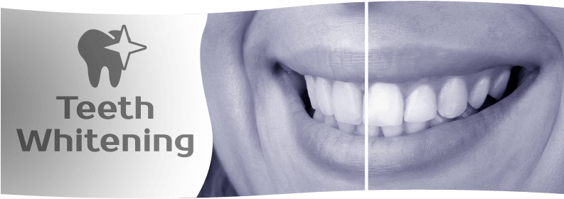 Who Wouldn't Want Sparkling White Teeth, Particularly - Activated Charcoal Powder 100g, Fine & Pure Food (800x292), Png Download
