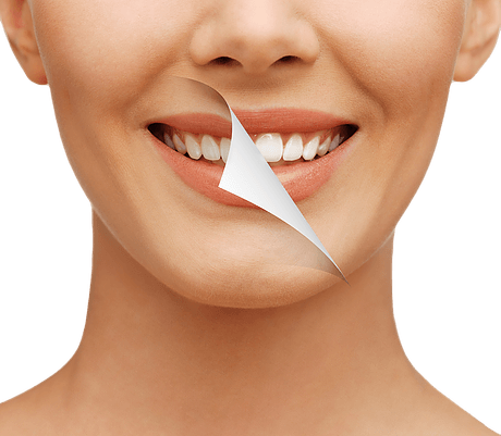 Teeth Restorations In Everett, Wa ~ All Smiles - Get Your Teeth White Again (460x401), Png Download