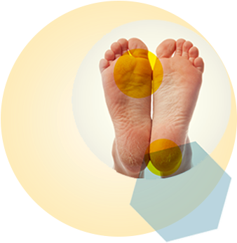 Soft Corns Form Between The Toes, And Stay Soft Due - Corn (400x400), Png Download