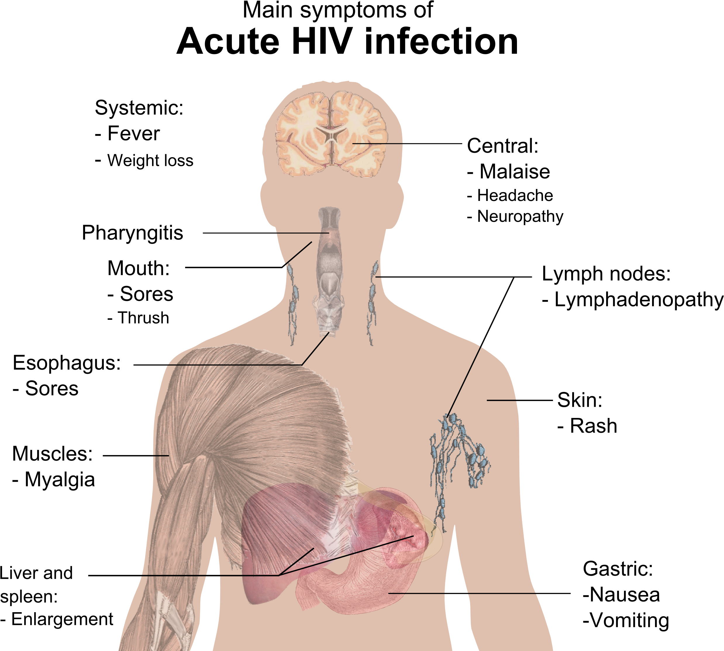 Symptoms Of Acute Hiv Infection - Hiv Symptoms (2519x2249), Png Download