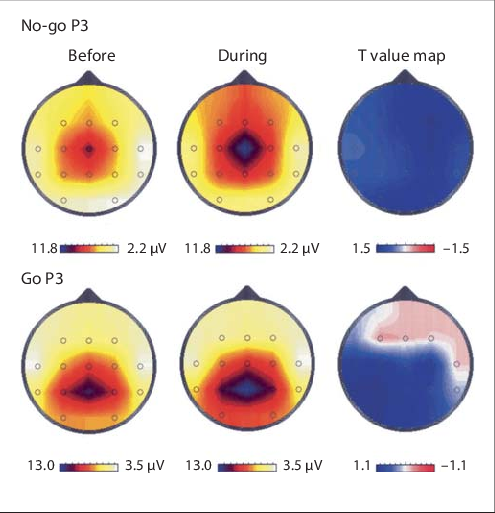 Comparison Of Go And No-go P3 Tm Before And During - Science (495x513), Png Download