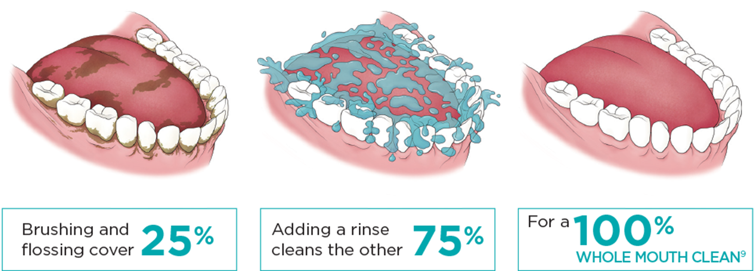 100% Whole Mouth Clean9 - Biofilm Mouth (1468x535), Png Download