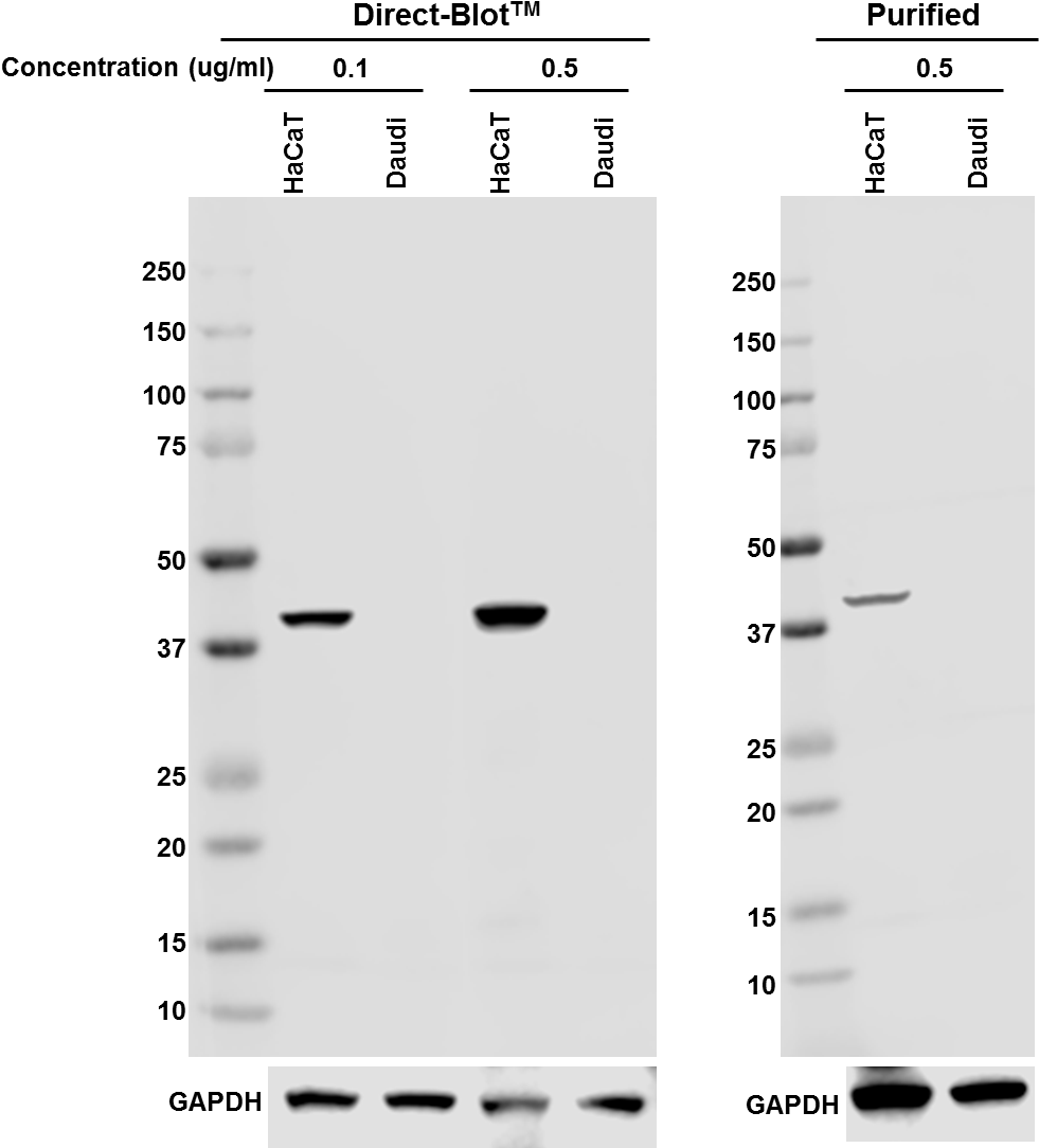 Direct Blot Hrp Anti Cytokeratin 19 Antibody Anti Cytokeratin - Antibody (995x1097), Png Download