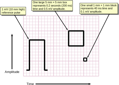 Ecg Paper V2 - Ecg Graph Paper (480x350), Png Download