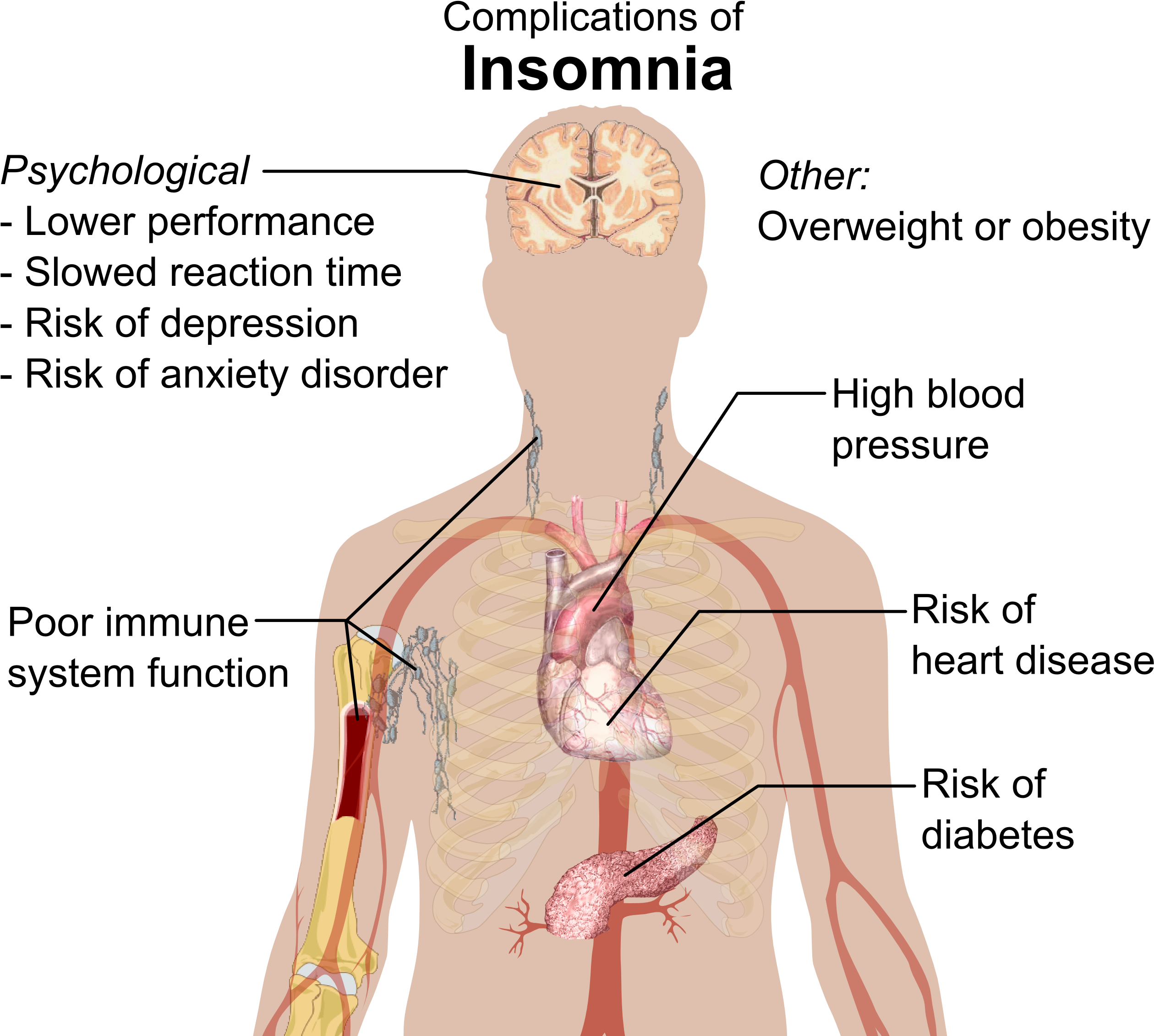 Complications Of Insomnia - Tell If You Have Insomnia (2556x2287), Png Download
