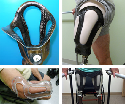 Sistema De Encaje Hifi - Prosthetic Socket Design (420x420), Png Download