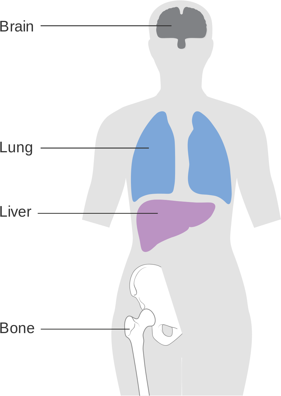 Breast Cancer Metastasis Site (1200x1488), Png Download