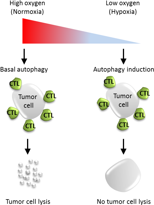 Figure 1 - - Autophagy Tumor (568x741), Png Download