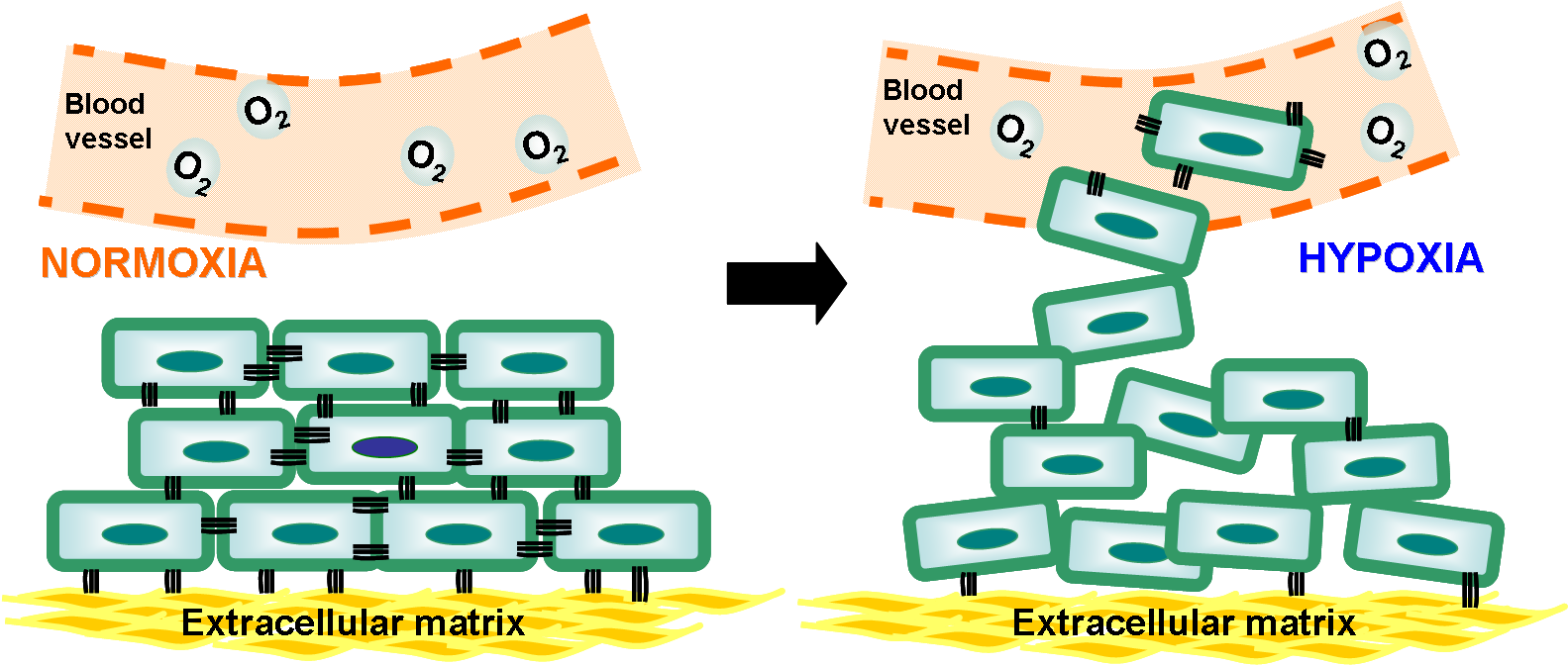 These May Prevent The Detachment Of Cancer Cells From - Hypoxic Cells In Cancer (1615x679), Png Download